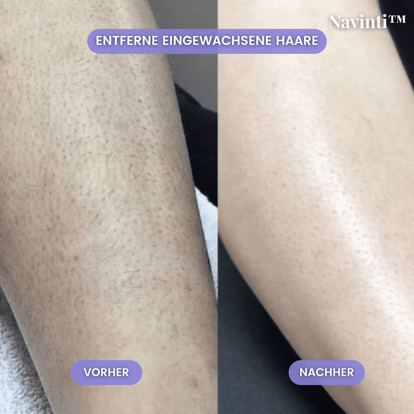 Navinti™ SensitivSkin Rasierer