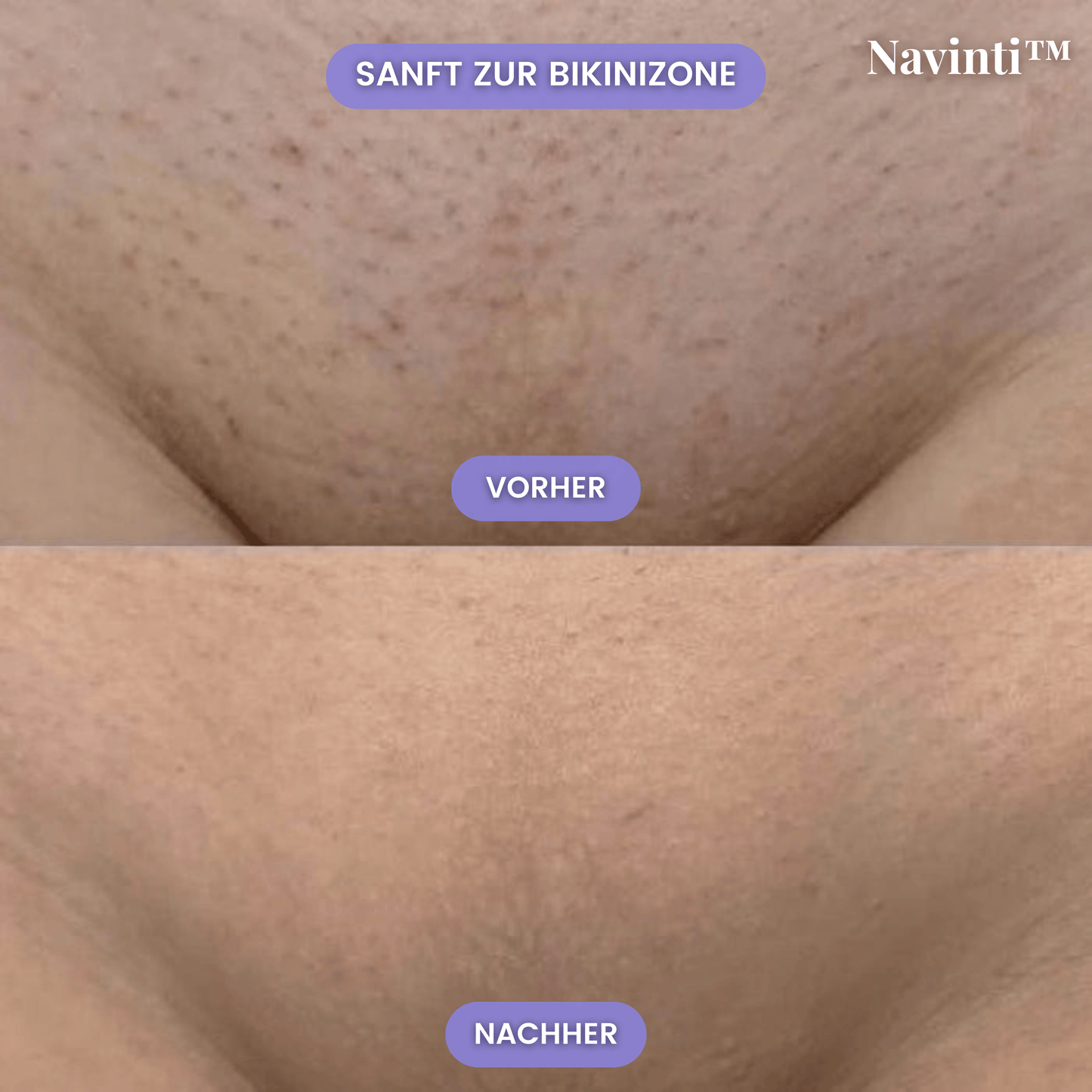 Navinti™ SensitivSkin Rasierer