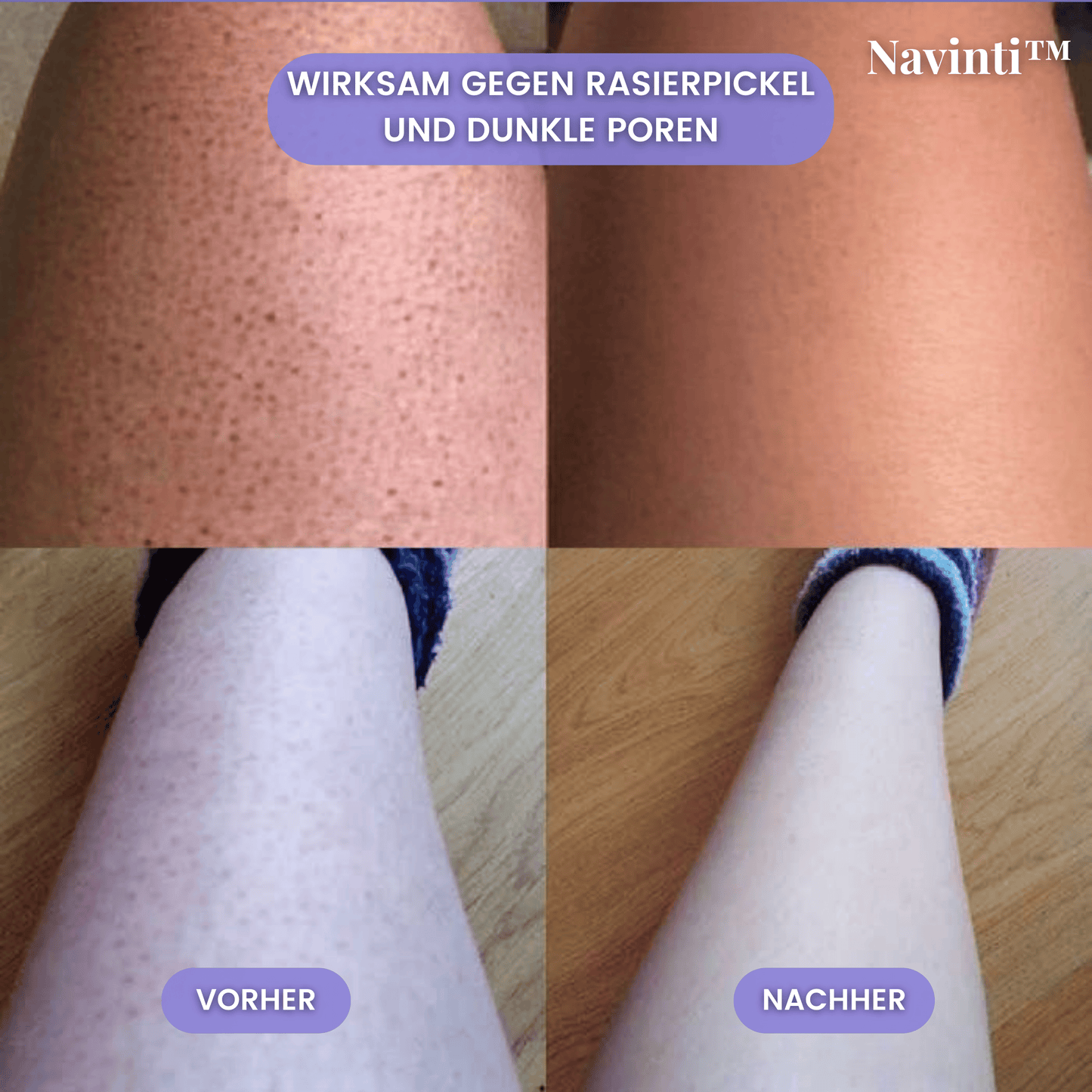 Navinti™ SensitivSkin Rasierer